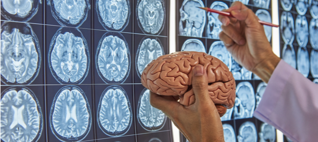 عيادات مخ وأعصاب